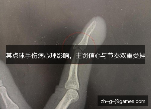 某点球手伤病心理影响,主罚信心与节奏双重受挫 某点球手伤病心理影响,主罚信心与节奏双重受挫